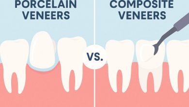 porcelain-veneers-vs.-composite-veneers:-which-is-right-for-you